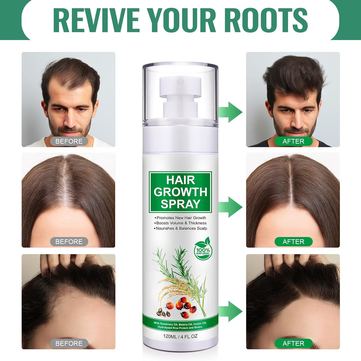 Hair Growth Serum Spray, Natural Hair Growth Spray With Biotin, Batana, Rosemary, and Castor Oil, Caffeine Ginseng Scalp Care Treatment, Thinning Hair Regrowth Thickening for Women Men 4 Fl Oz