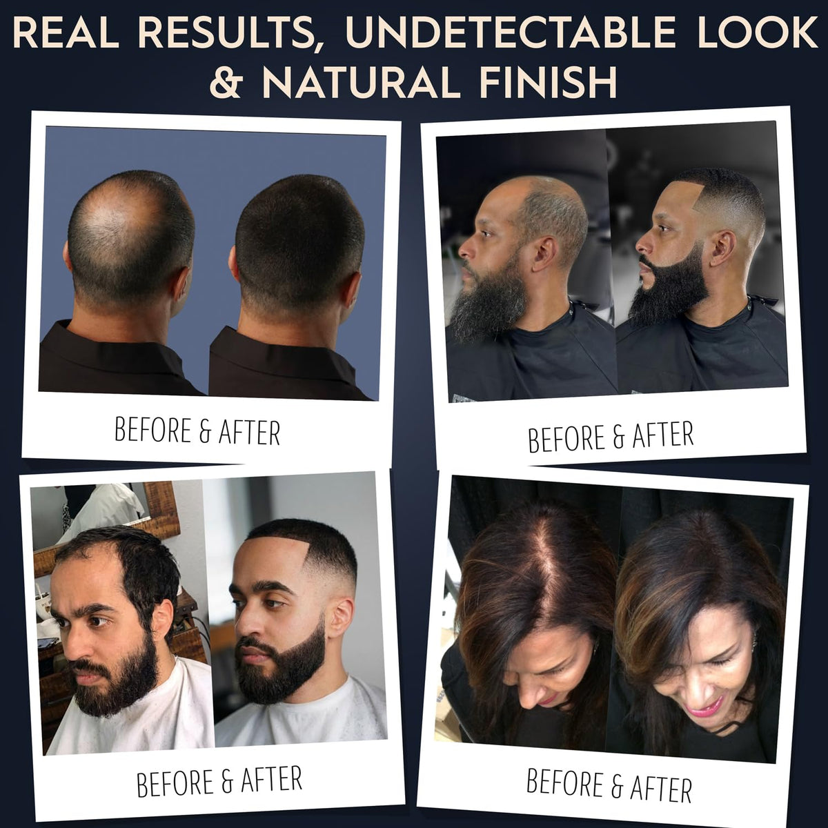 Hair Illusion Spray Applicator Removable Flat Tip designed to Spray Precise Hairline or Remove Tip For Round Sprayer And Wide Coverage (does not include hair fibers)