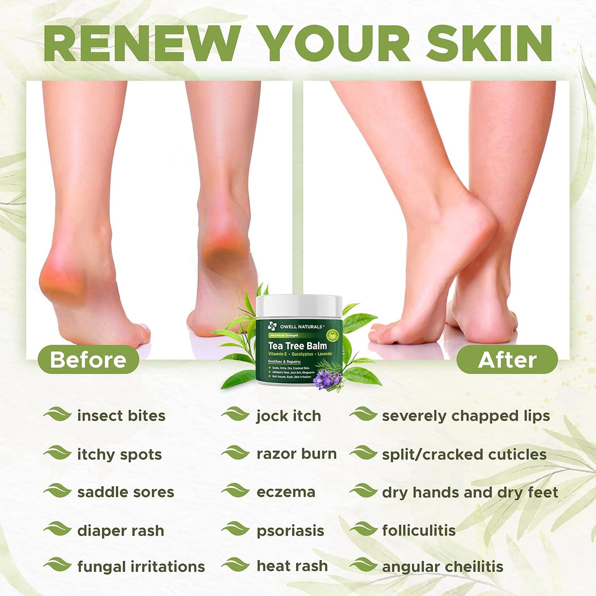 Owell Naturals Tea Tree Antifungal Balm – Extra Strength for Athlete’s Foot, Jock Itch, Ringworm & Skin Fungus – Soothing for Itchy, Dry, Cracked Skin, Feet & Body, 2 oz