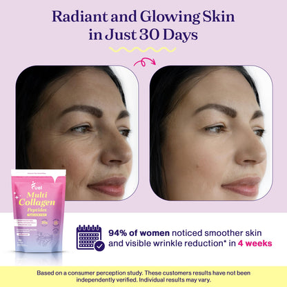 Fuel Multi Collagen Peptides Powder – 20g Hydrolyzed Collagen Types I, II, III, V & X – Hair, Skin, Nails & Joint Support – Keto & Gluten Free – Unflavored – 40 Servings (16.64oz) - PrimeBioHealth - canada supplements