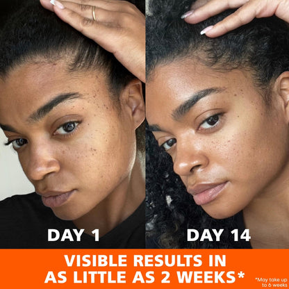 Palmer's Skin Success Anti-Dark Spot Fade Cream with Vitamin E and Niacinamide, for All Skin Types 2.7 Ounce - PrimeBioHealth - canada supplements