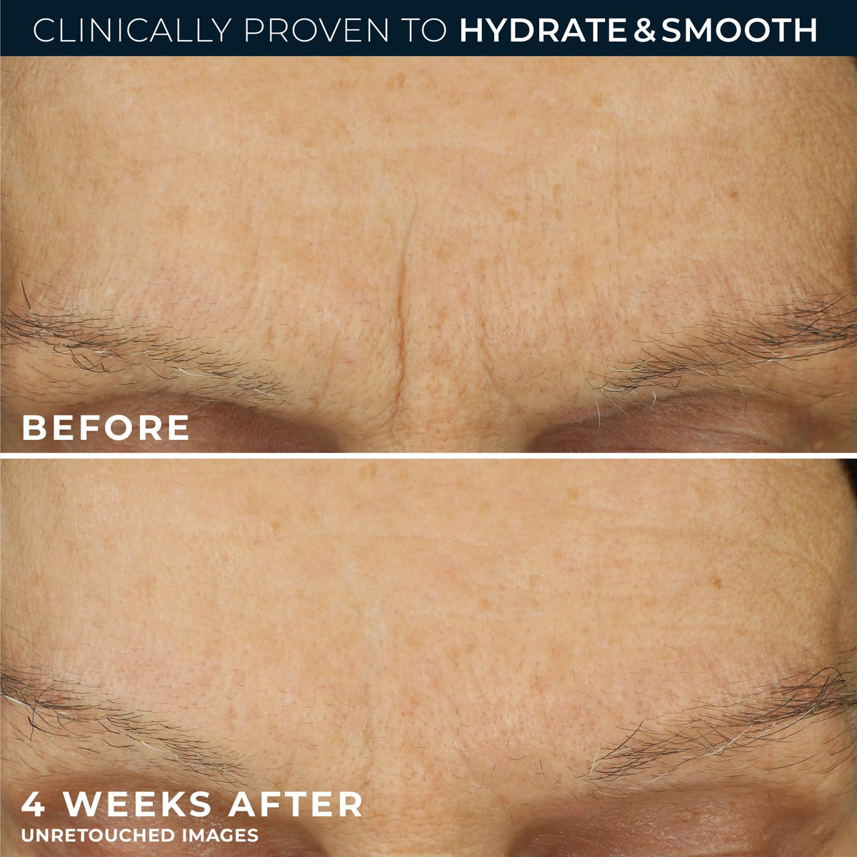 RoC Retinol Correxion Max Daily Hydration Anti-Aging Face Moisturizer with Hyaluronic Acid - PrimeBioHealth - canada supplements